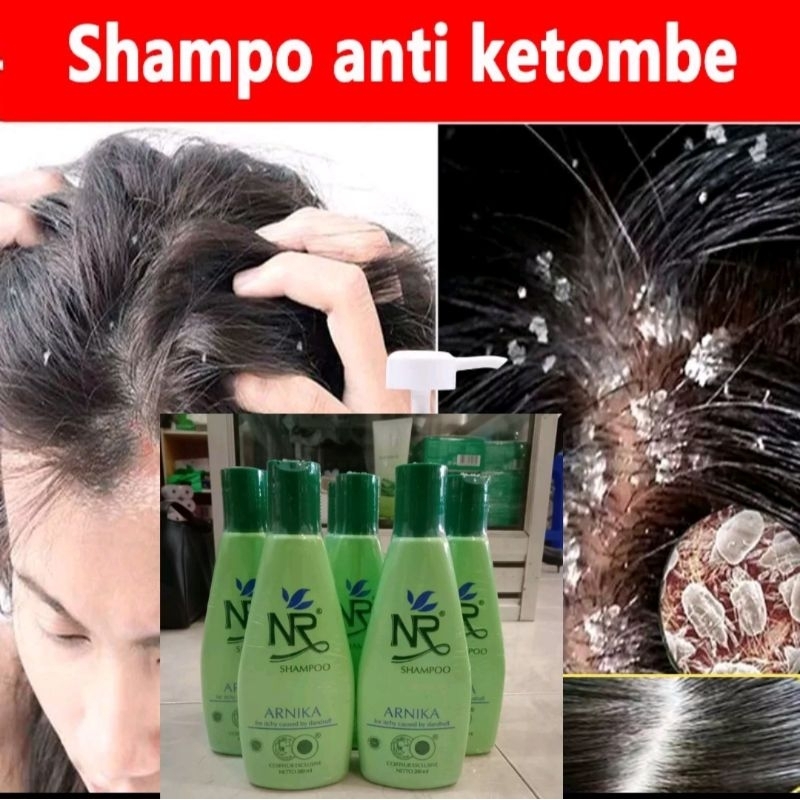 NR SHAMPOO Arnika / Protein / Citrone / El 200ML