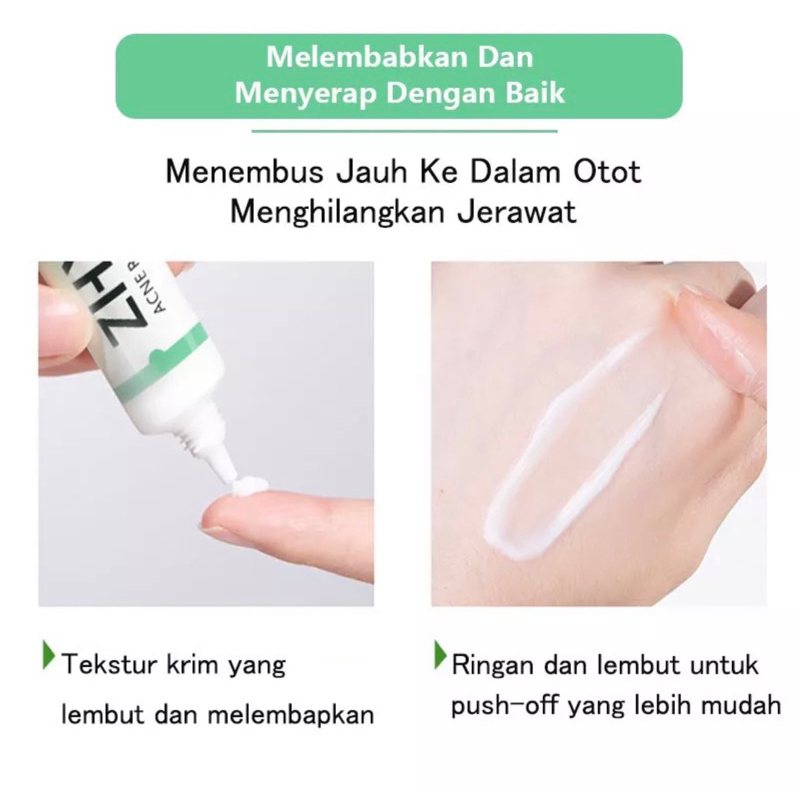 ZHENXIU krim gel anti  jerawat/ salep jerawat 20 gr