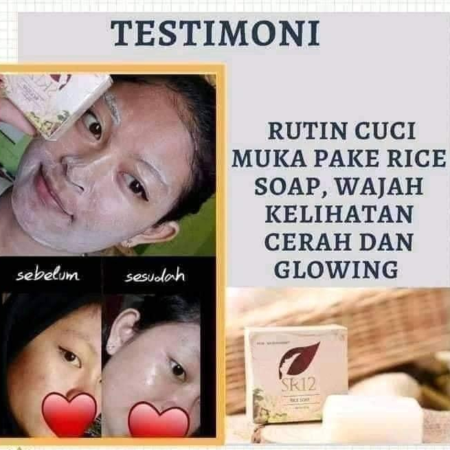 SR12 Skincare Sabun Beras Pengecil Poripori Wajah Penghilang Jerawat Flek Hitam Atasi Kulit Kusam Dan Minyak Berlebih SR 12 RICE SOAP