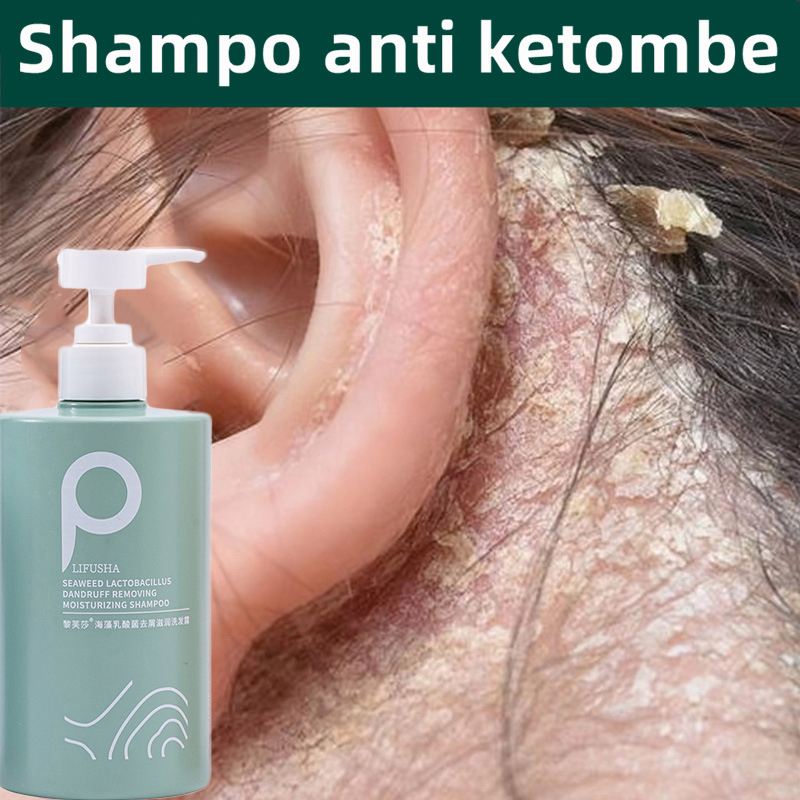 Anti-dandruff shampoo Sampo anti ketombe Shampo anti rontok Pengontrol minyak, anti-gatal, anti-ketombe, anti-penumpahan Bahan garam laut impor, penghilangan tungau 99%.Shampo anti ketombe dan anti gatal paling ampuh di Indonesia