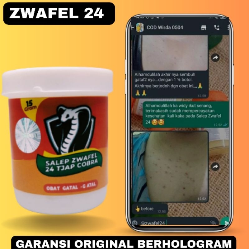 Salep Gatal Zwafel 24 Original 100% Obat Saleb Gatal Panu Kadas Kurap Kutu Air