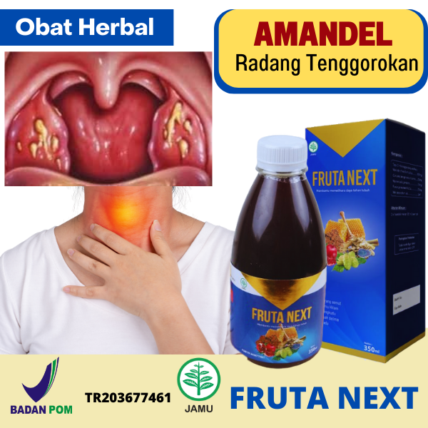 Obat Amandel Akut, Kronis, Bengkak, Obat Benjolan Di Tenggorokan - Frutanext Herbal Ampuh Radang Ten