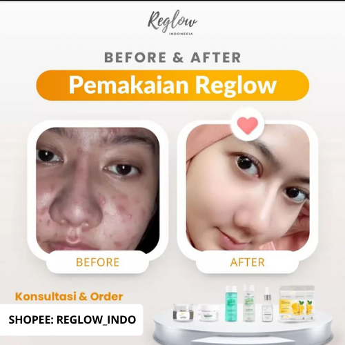 Paket Reglow Untuk Kulit Sensitif Facial Wash + Day Cream + Serum