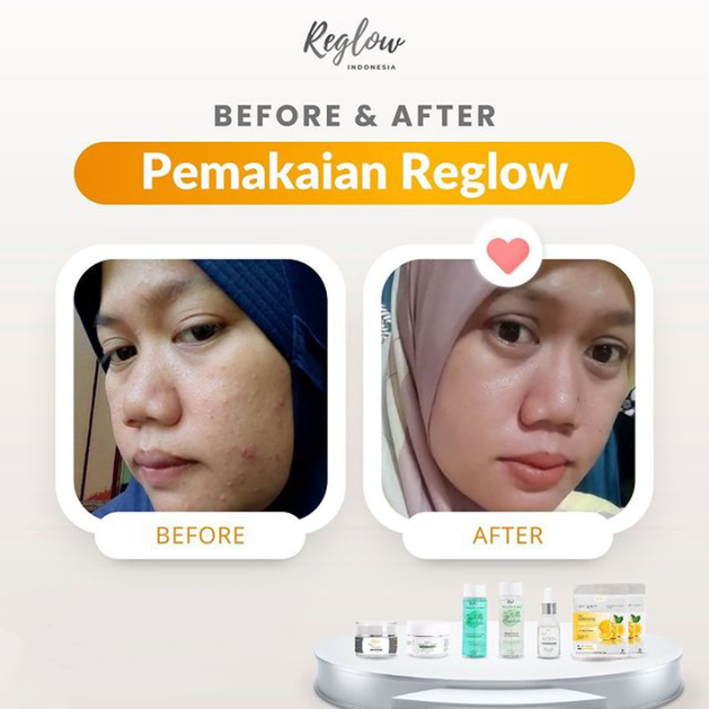 Paket Reglow dr Shindy Skincare + Serum Lengkap Original Bpom Halal