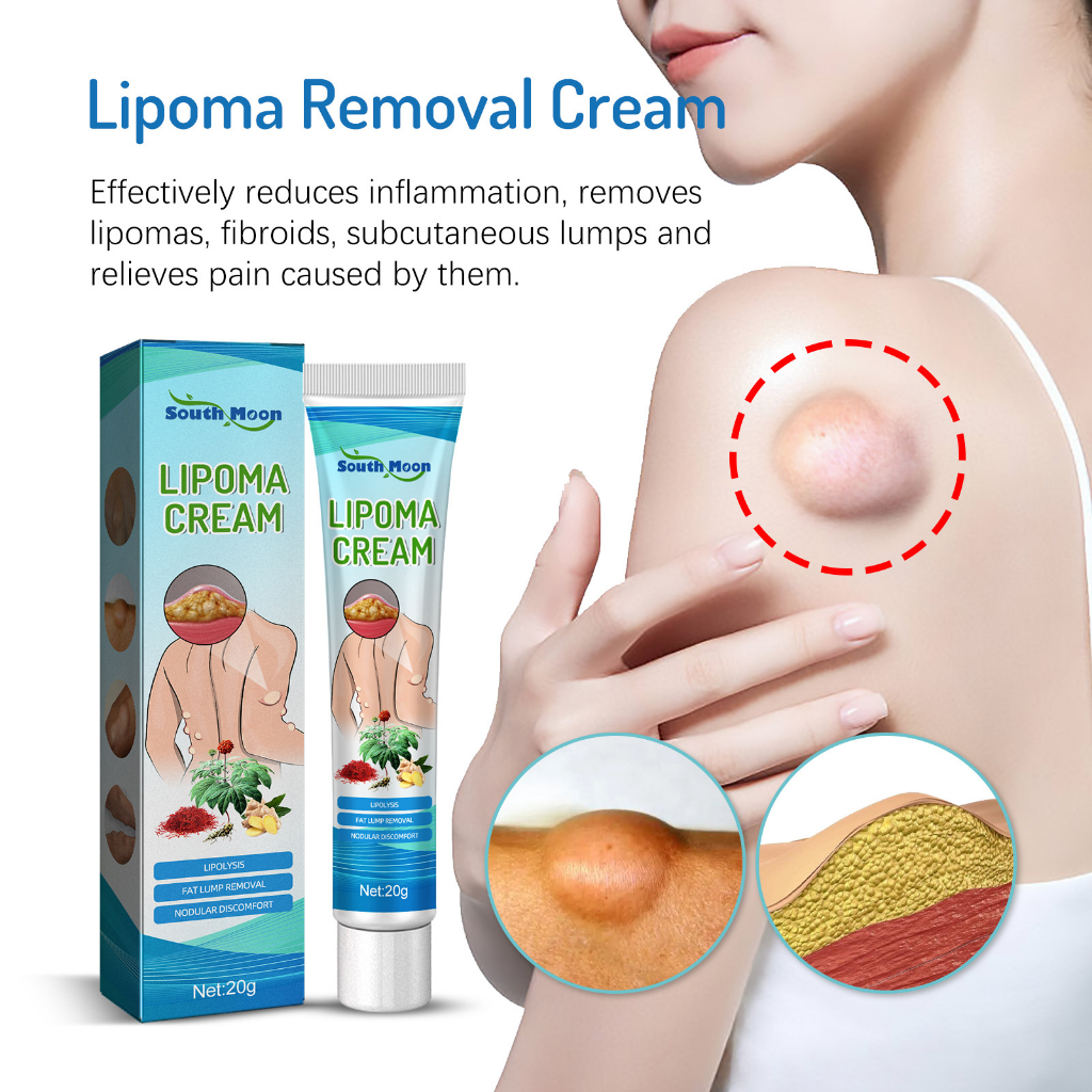 Obat Benjolan Obat Benjolan Lipoma Untuk Leher/Tangan/Ketiak/Punggung Pundak/Kaki - Lipoma Removal Cream 20gr ORI 100%