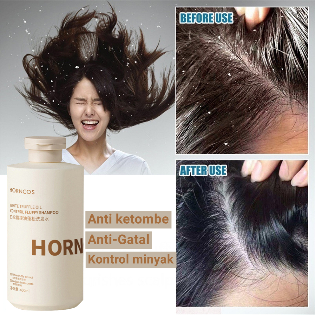 Shampo Anti Ketombe &amp; Anti Gatal dan Mencegah Rambut Rontok Sampo Kontrol Minyak Garam Laut Shampoo Anti Tungau 400ml Original