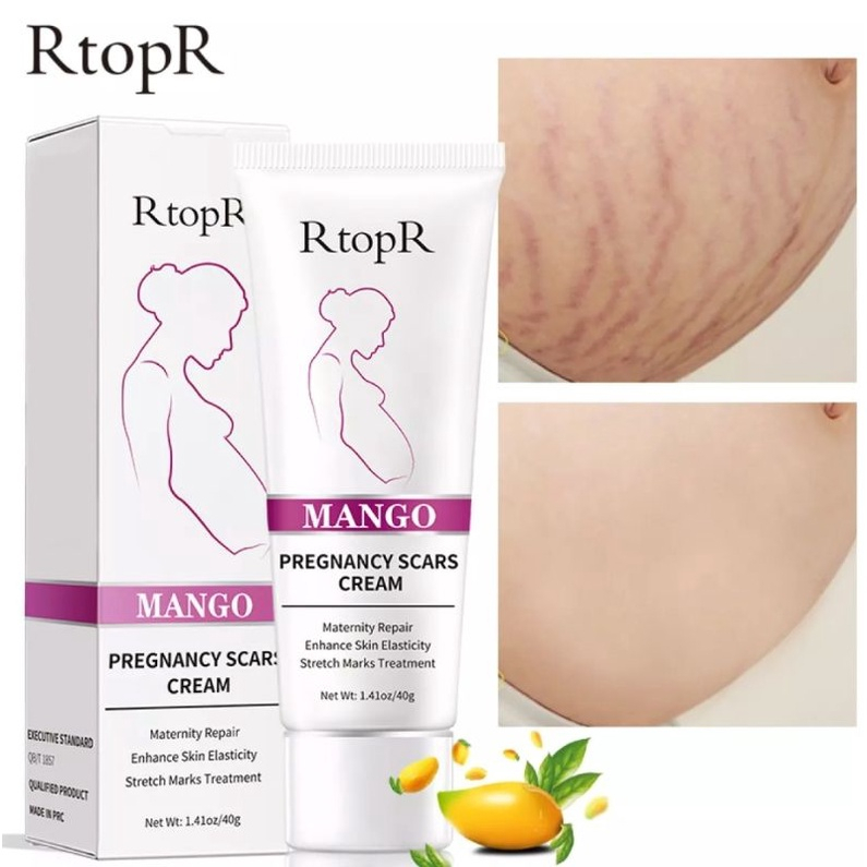 RtopR Mango Remove Pregnancy Scars Acne Cream Stretch Marks Treatment Maternity Repair Anti-Aging Anti-Winkles Firming Body Creams