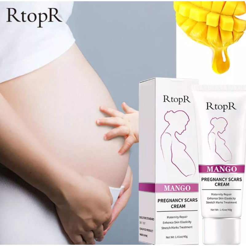 RtopR Mango Remove Pregnancy Scars Acne Cream Stretch Marks Treatment Maternity Repair Anti-Aging Anti-Winkles Firming Body Creams