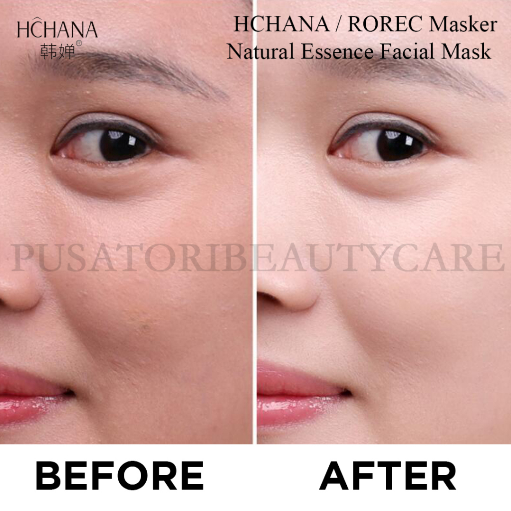 HCHANA / ROREC Masker Natural Essence Facial Mask