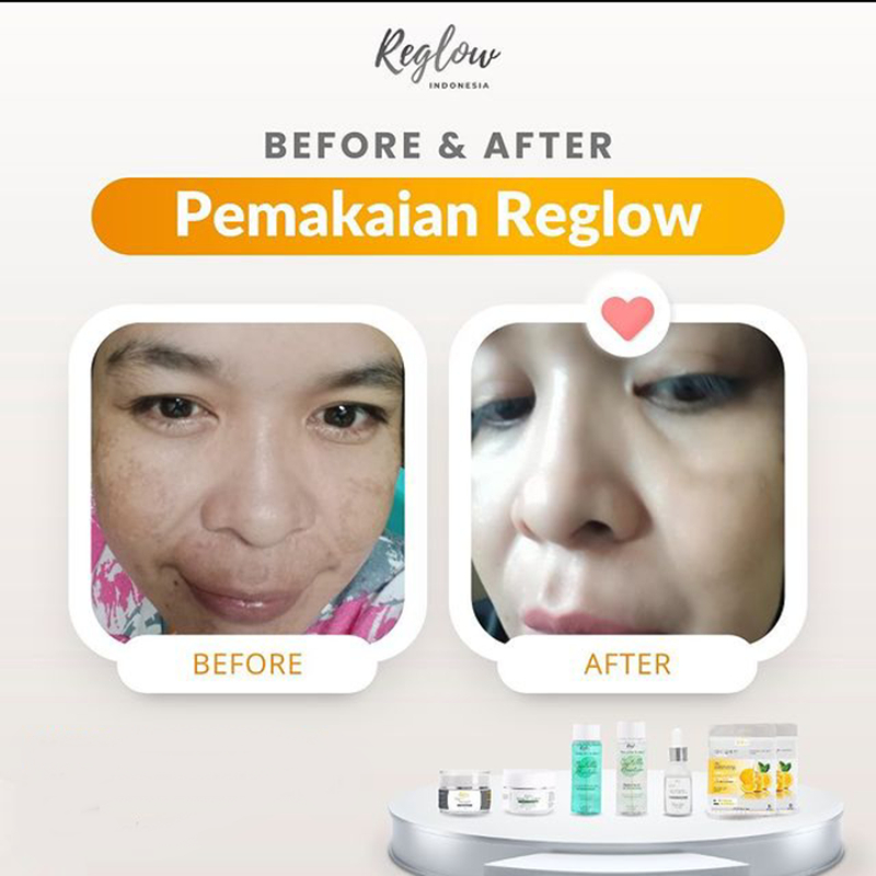 Paket Reglow + Serum dr Cindy Skin care Reglow Original Paket Lengkap