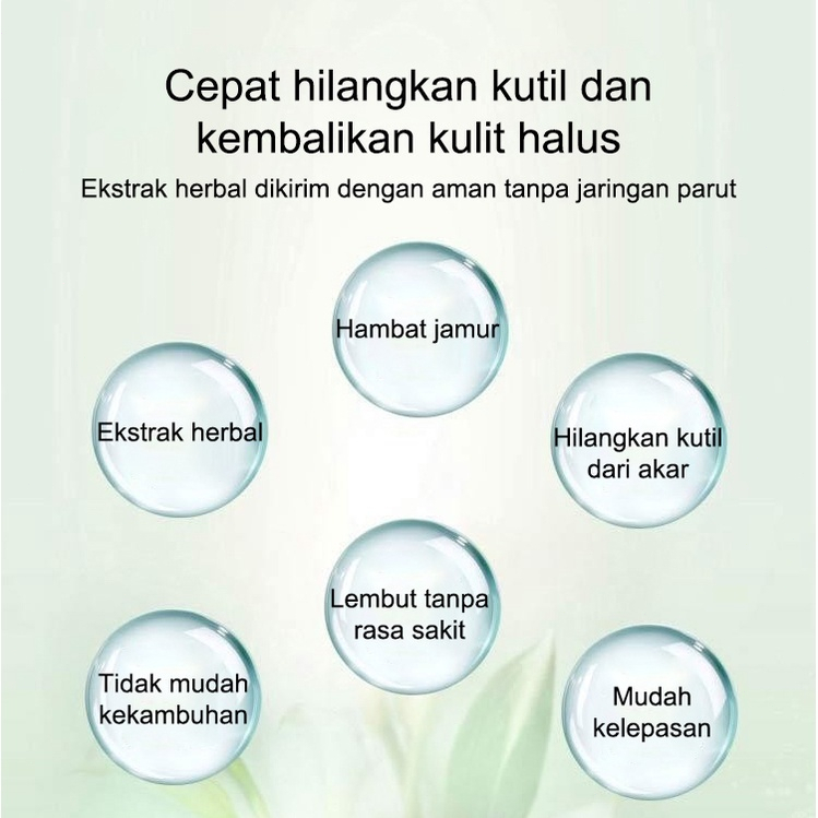 Krim kutil obat penghilang kutil penghilang kutil 20g skin tag remover Menghilangkan kutil, tahi lalat, berbagai skin tag di berbagai bagian tubuh