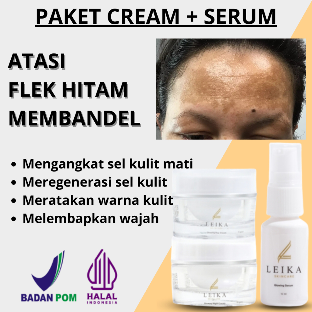 Paket Atasi Flek Hitam Cream penghilang flek hitam Krim pemudar flek Krim bintik hitam Krim penghila