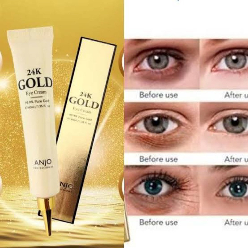 🇰🇷 Anjo Wrinkle Eye Cream 99% Pure Gold