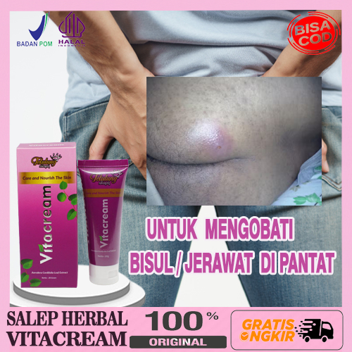 Salep Bisul di Pantat, Obat Bisul Menahun di Pantat Pria Wanita Tetulung Vita Cream Perontok Bisul A