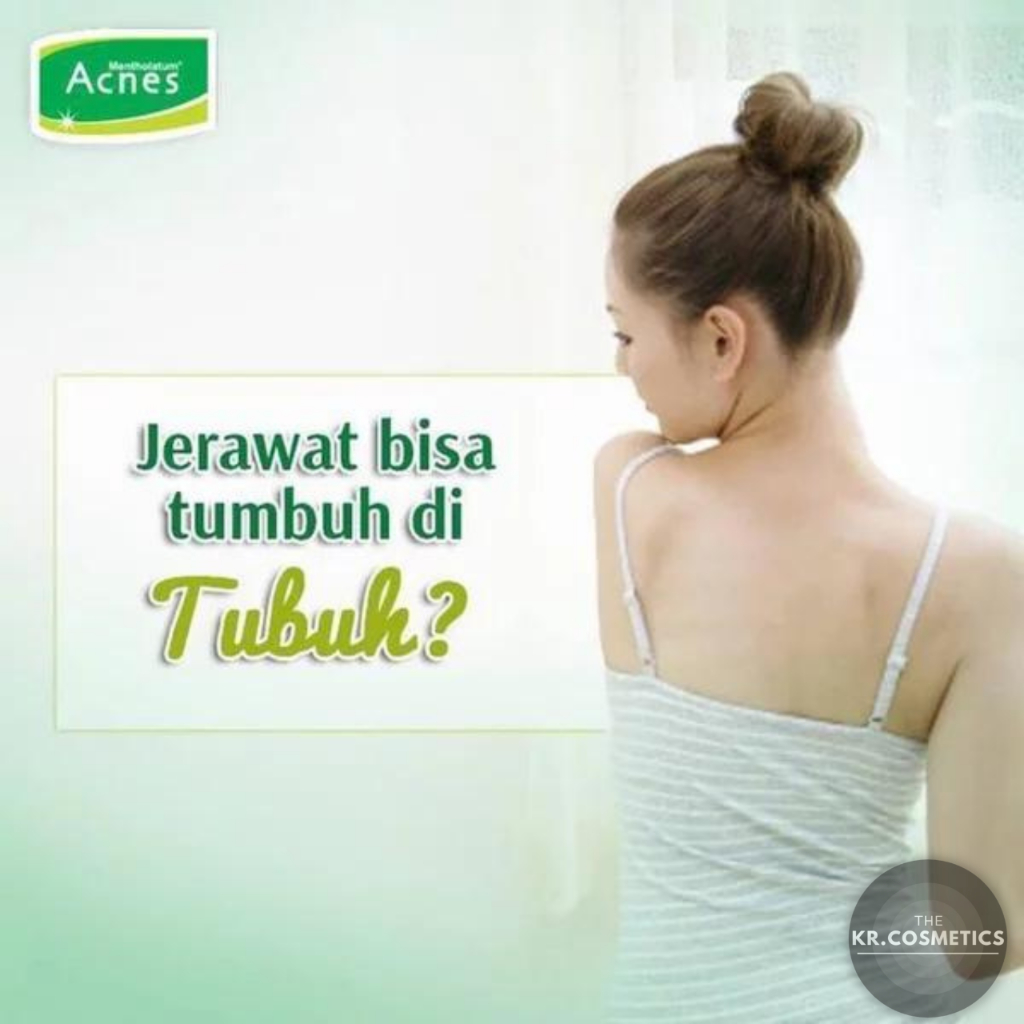 Acnes Washing Bar Sabun Jerawat badan 80 gr