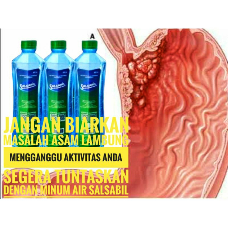 

Obat asam lambung maagh membantu menetralkan asam lambung secara alami isi 5 botol