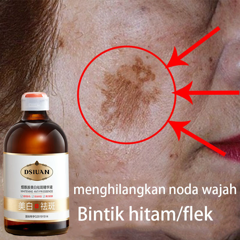 Penghilang flek hitam di wajah Serum Pemutih wajah sabun pemutih wajah Night whitening salep flek hitam Penghilang flek hitam Salep Flek Hitam Melasma 100ML Secara efektif mengatasi flek hitam dan kulit hitam/Memutihkan kulit，memperbaiki kulit