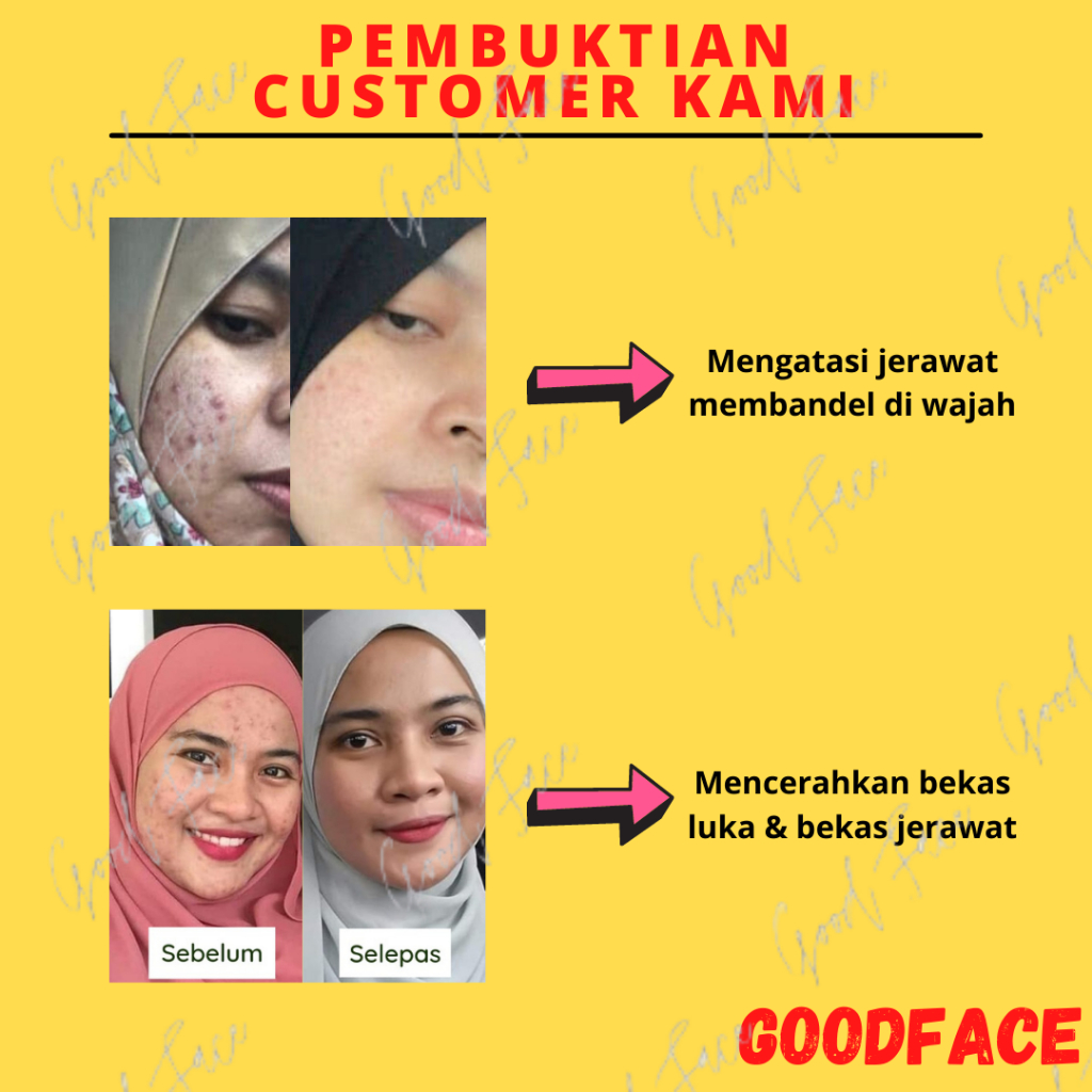 BREYLEE Bundle Hemat, Step 1 I Step 2 I Acne Treatment serum I 3pcs