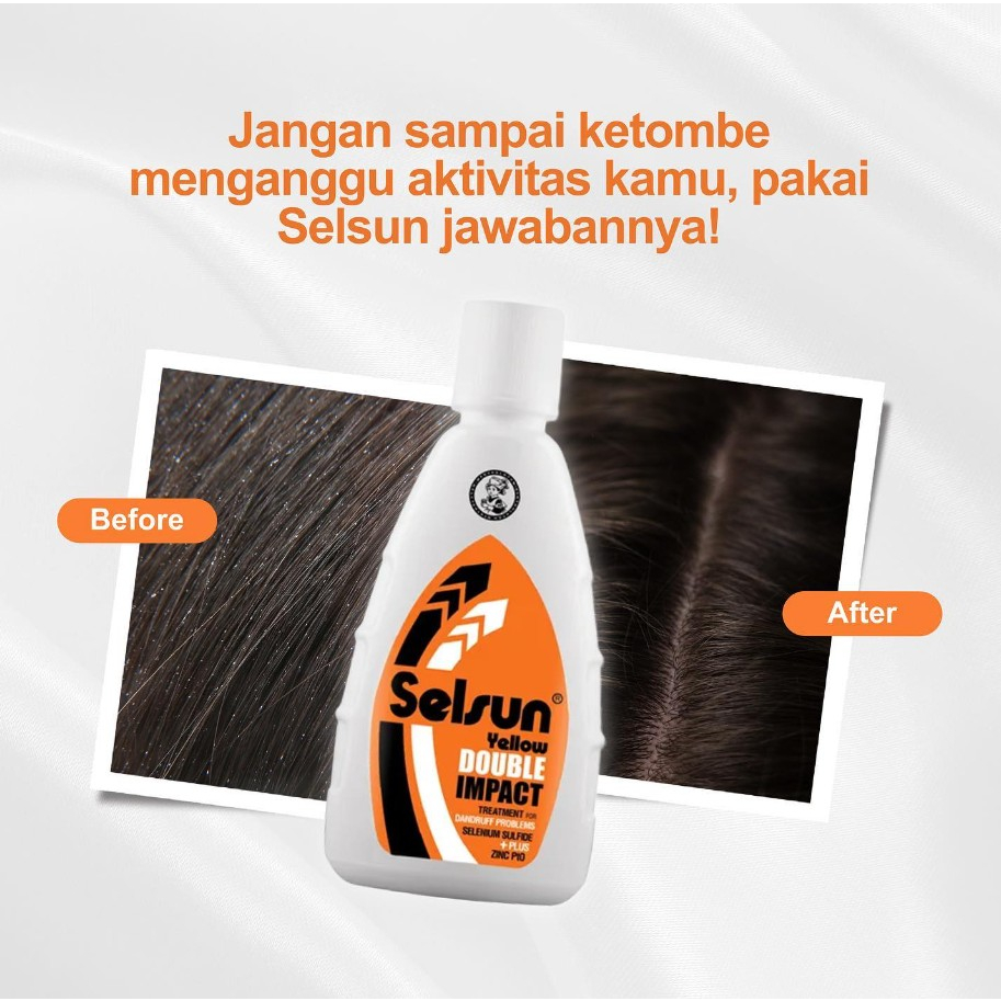 [BPOM] Selsun Yellow Double Impact Shampoo 50 ml / Selsun Shampo Anti Ketombe 50ml / Sampo / MY MOM