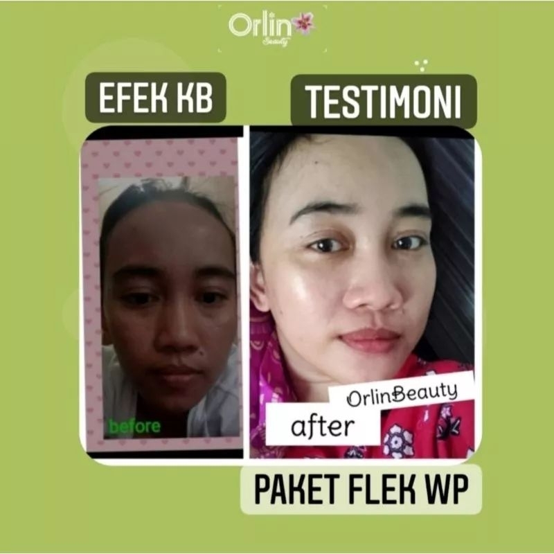 SERUM UNTUK FLEK/ SERUM ANTI AGING ORLIN BEAUTY/ SERUM ORLIN BEAUTY