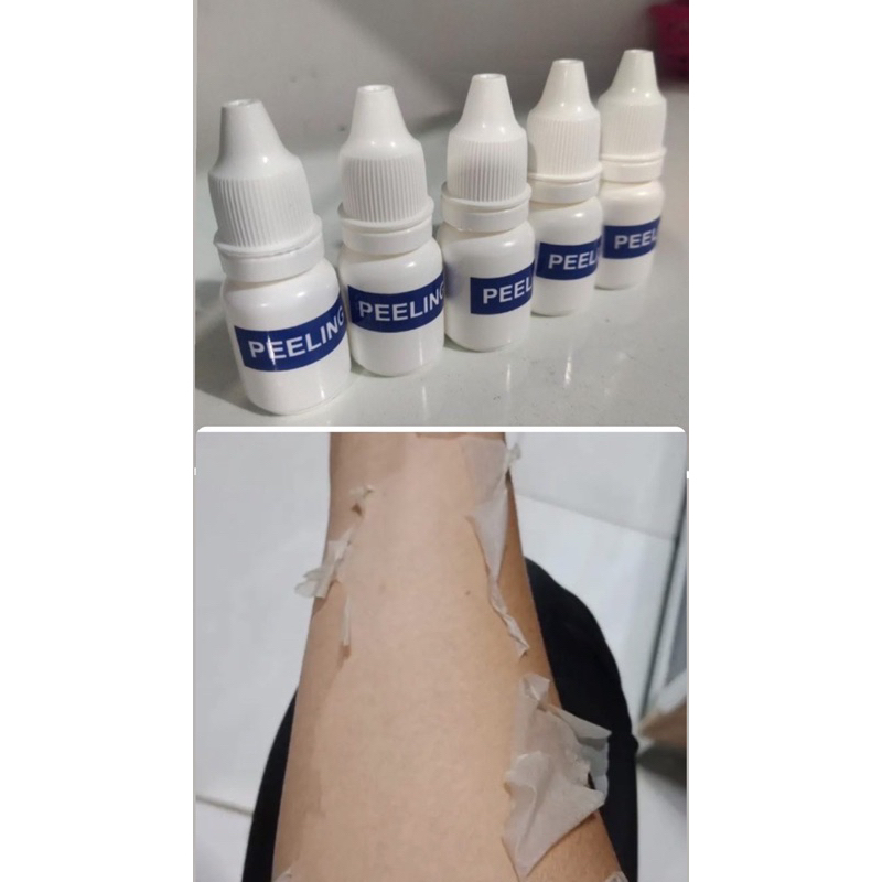 Peeling Badan