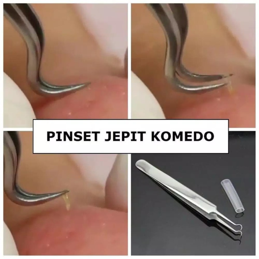 Pinset Jepit Komedo Stainless Steel Blackhead Tweezer Alat Capit Untuk Menghilangkan Komedo Penjepit Komedo