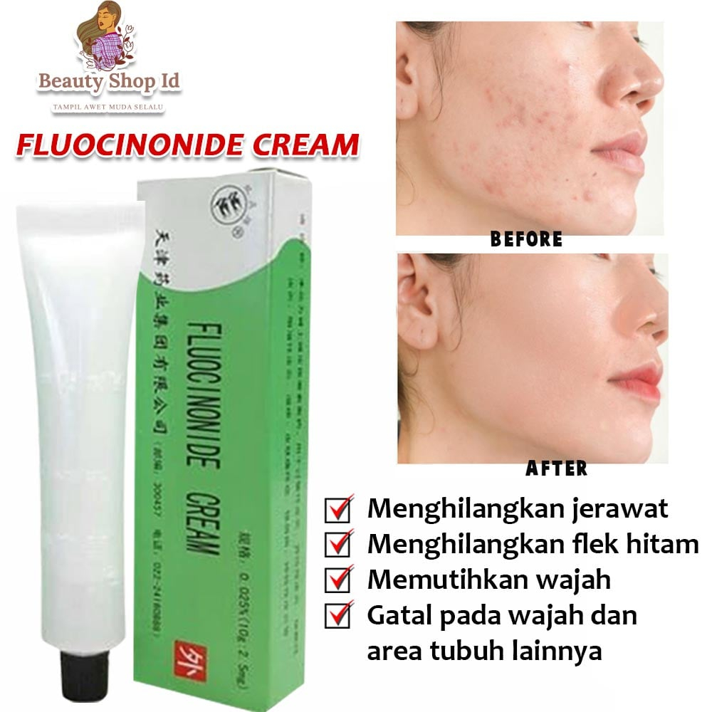 Beauty Jaya - Salep Walet Lightening Cream Salep Gatal Kulit Paling Ampuh / Obat Gatal Gatel2 Seluruh Badan