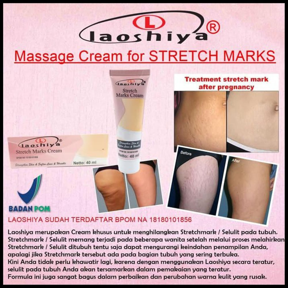 LAOSHIYA CREAM PENGHILANG STRECMARK