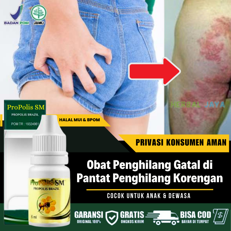 Salep Pantat Gatel Menahun, Infeksi Jamur Gatal Meradang di Malam Hari Penghilang Bekas Luka Hitam di Pantat, Penghilang Gatal di Bokong, Ruam Merah Bruntusan Kaligata di Bokong, Obat Gatah Darah Manis di Bokong, Pembersih Korengan di Bokong - Propolis SM