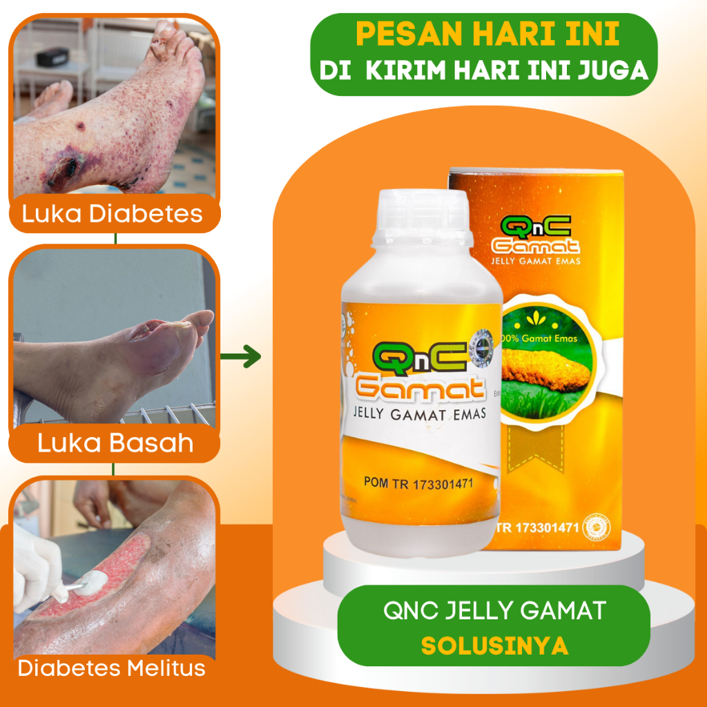 Obat Pengering Luka Cepat Kering|Obat Pengering Luka Diabetes|Obat Luka Diabetes Basah|Bernanah|Obat