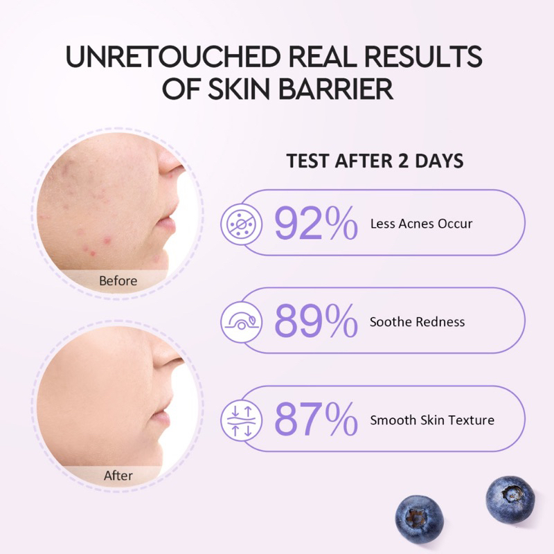 【Official Outlet】GLAD2GLOW Moisturizer Blueberry Centella Serum Acne Niacinamide Brightening Essence Toner AHABHA Propolis Rosehip Face Oil Acne Spot Patch Day Night Cream Mugwort Clay Mask Stick Peptide Eye Cream Sunscreen SPF50 Pemutih Pencerah Viral