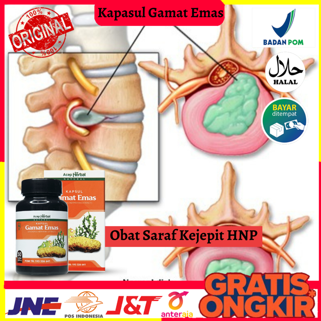 Obat Saraf Kejepit HNP, Obat Syaraf Terjepit, Obat Saraf Kejepit Pinggang dan Kaki, Obat Saraf Kejep