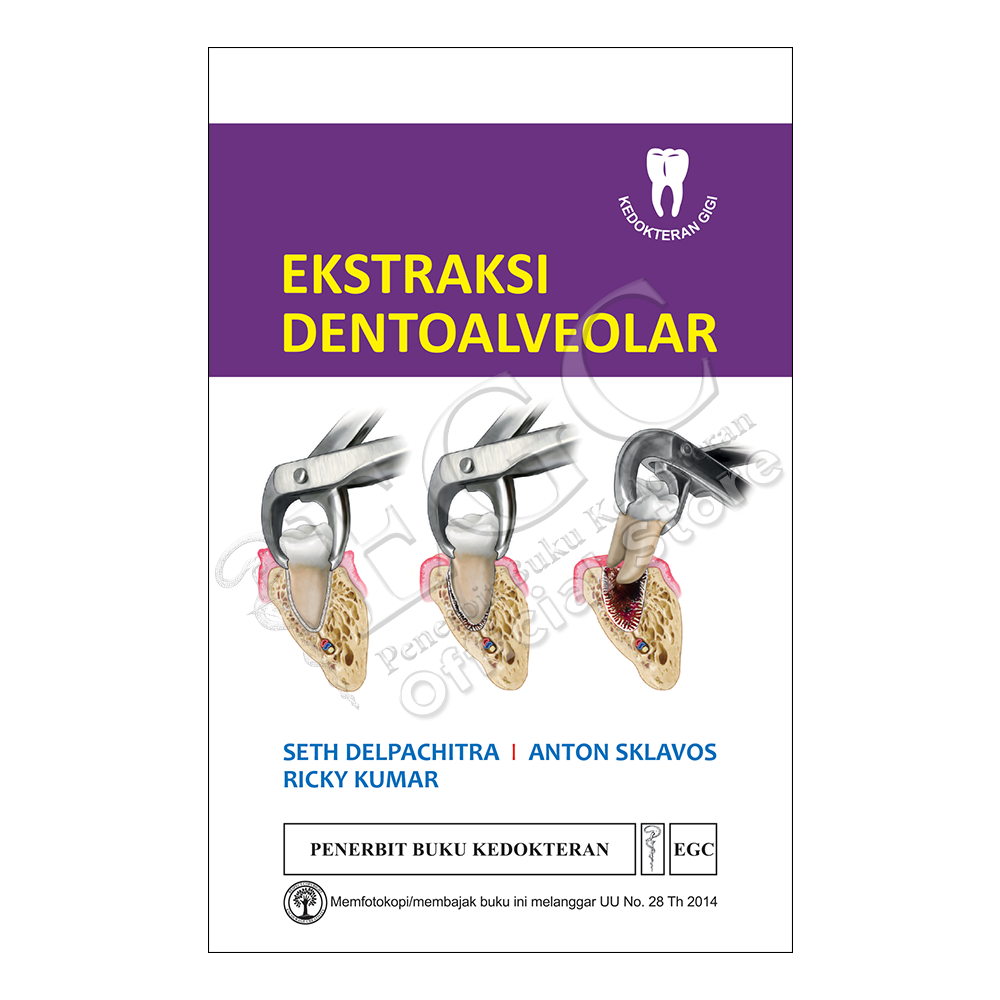 EGC Ekstraksi Dentoalveolar