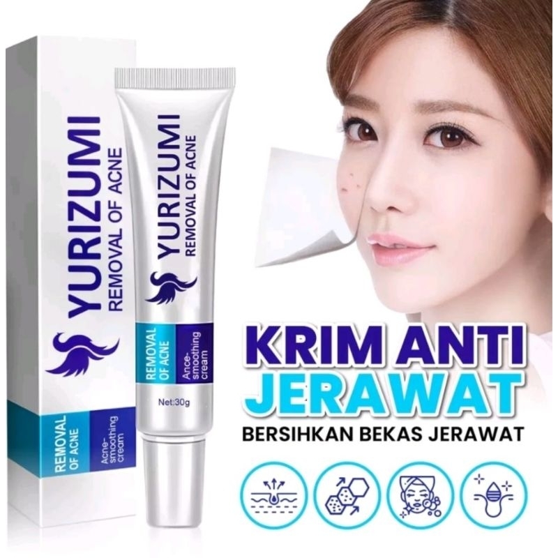 Yurizumi Acne Pure Skin Cream Obat Jerawat Paling ampuh Menghilangkan Jerawat dan Bekas