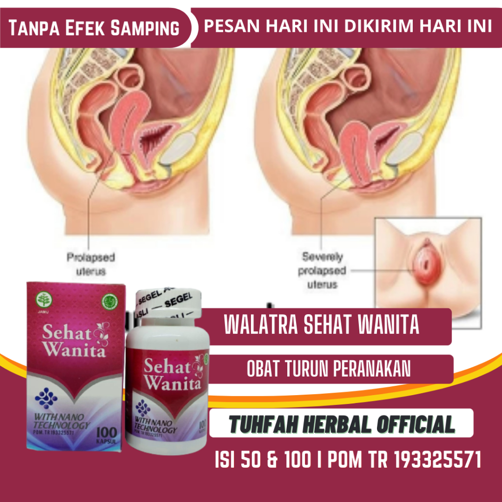 Obat Turun Peranakan Wanita, Prolaps Rahim Turun, Turun Berok, Peranakan Turun, Benjolan Vagina, Oba