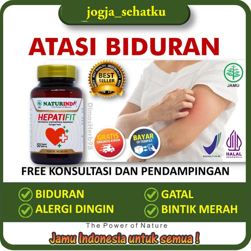 Obat Biduran Alergi Kaligata Gatal Gatal Hepatifit Naturindo Biduran Kronis Akut Menahun