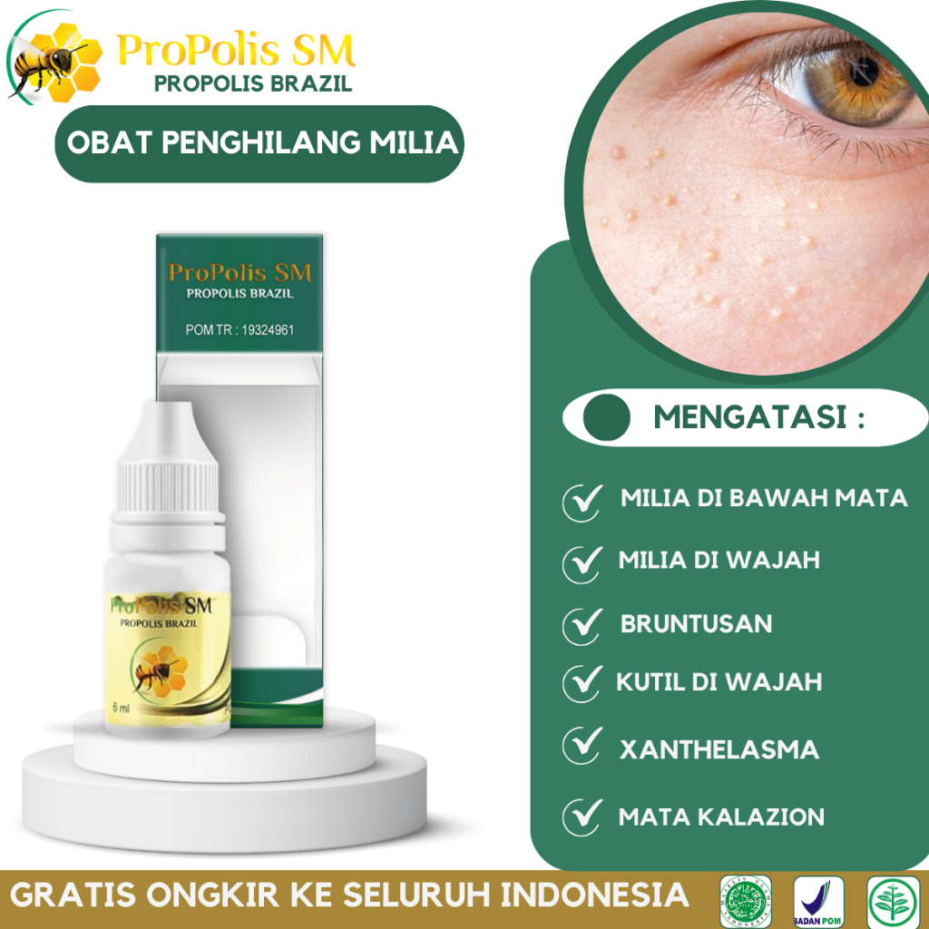 Penghilang Milia Di Bawah Mata,  Milia Di Wajah, Khusus Milia Pada Mata, Bruntusan Kecil Wajah, Jera