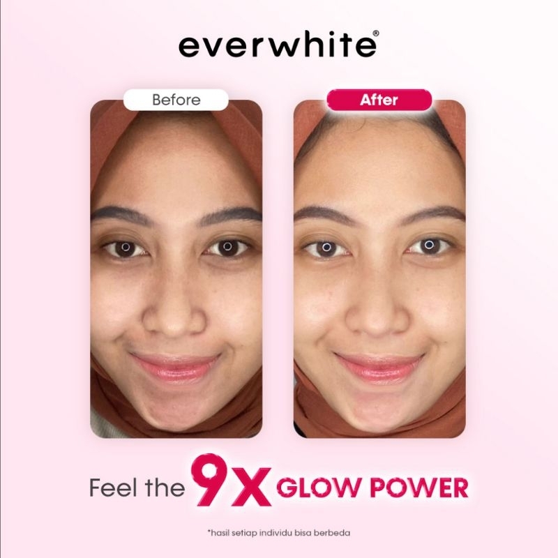 EVERWHITE Hicolla Minuman Kolagen Pencerah