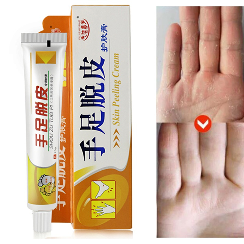 SALEP KAKI PECAH KAPALAN KERING OBAT TUMIT KASAR PECAH PECAH [SHOU ZU TUO PI]