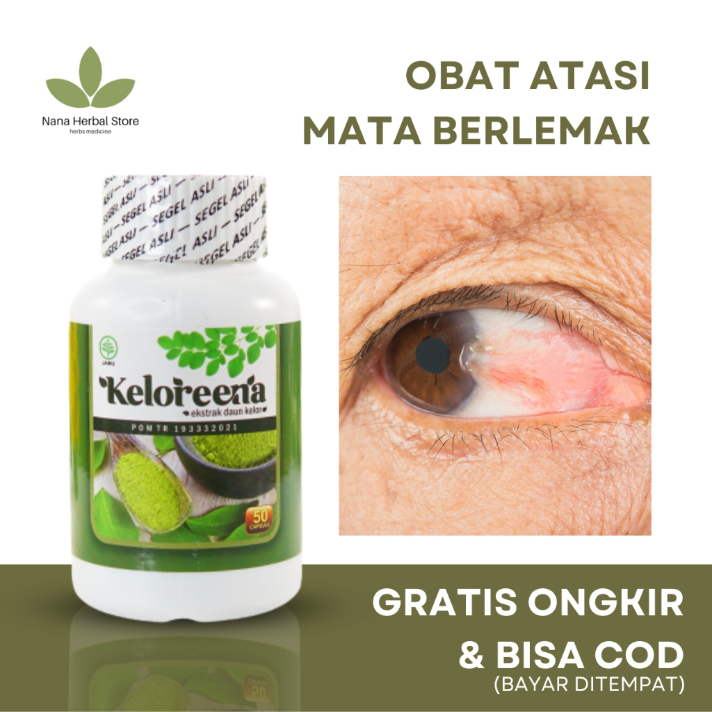 Keloreena Obat Mata, Obat Mata Berlemak Pterigium, Obat Mata Katarak, Obat Mata Merah Berurat, Obat 
