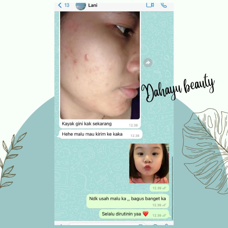 THERASKIN PAKET ACNE GLOW