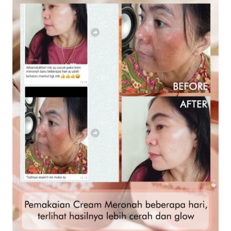 Agen Resmi Krem Meronah Whitening Cream Pemutih Wajah Kream Glowing 2in Pelembab Wajah Krim Whitening Glow