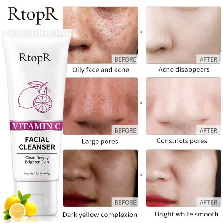 Rtopr Vitamin C Facial Cleanser Whitening Face Wash Dark Spot Moisturizer Collagen-Sabun Pembersih- Muka Memberikan Wajah dan Pori-Pori Wajah Putih Berseri-40gr