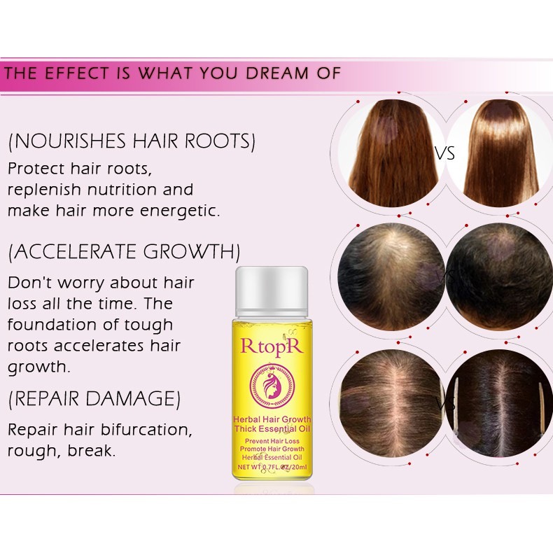 RtopR Herbal Hair Growth Thick Essential Oil Produk Pertumbuhan Rambut Minyak Esensial/RtopR Herbal Hair Growth Thick Essential Oil
