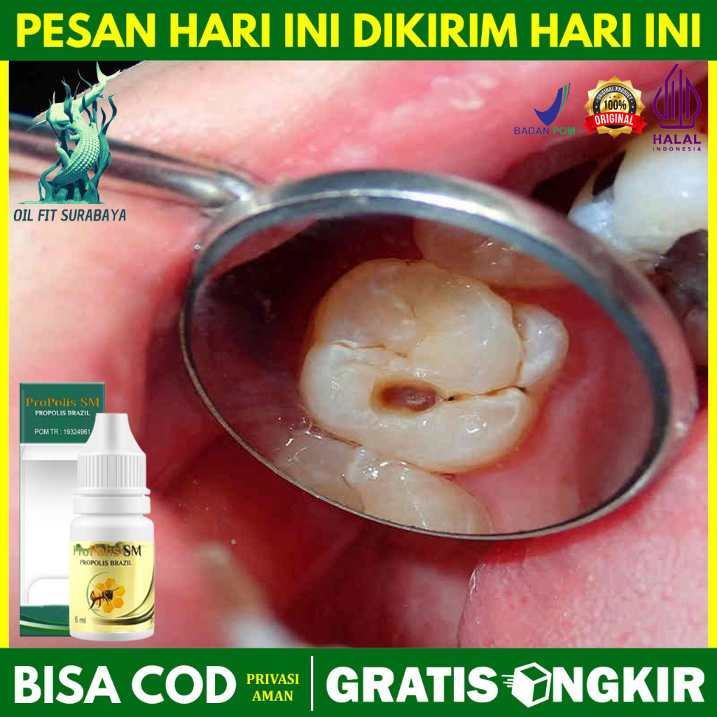 Obat Kumur Untuk Mengeluarkan Ulat Gigi - Ulat Pada Gigi Berlubang - Ulat Dalam Gigi Berlubang - Ula