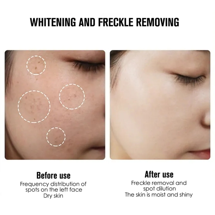 SK FI DIOR-SK Whitening Freckle Cream Remove Dark Spots Anti Freckle Cream Niacinamide Fade Pigmentation Melasma Brighten Creams-Krim Perawatan Kulit Pelembap Pemutih - Pigmentasi Mencerahkan