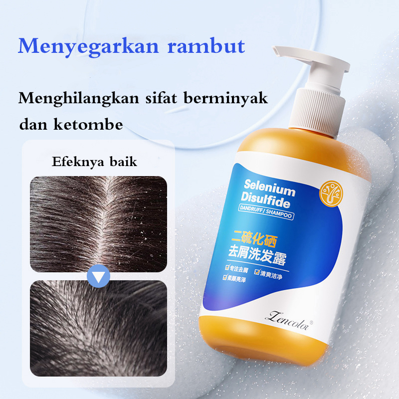 Obat ketombe Sampo ketombe Obat Ketombe Rambut Rontok Berkerak Sampo 300ML Efesiensi menghilangkan ketombe/Cepat anti gatal/Memuluskan rambut/Menjaga kulit kepala