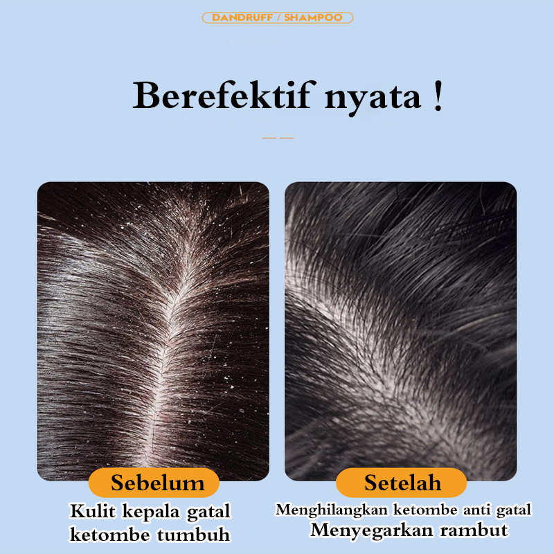 Obat ketombe Sampo ketombe Obat Ketombe Rambut Rontok Berkerak Sampo 300ML Efesiensi menghilangkan ketombe/Cepat anti gatal/Memuluskan rambut/Menjaga kulit kepala