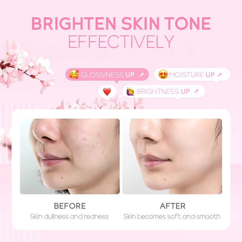 Fenyi Japan Cherry Blossom Toner Melembabkan Mencerahkan Noda Bintik-Bintik Hitam 100ml