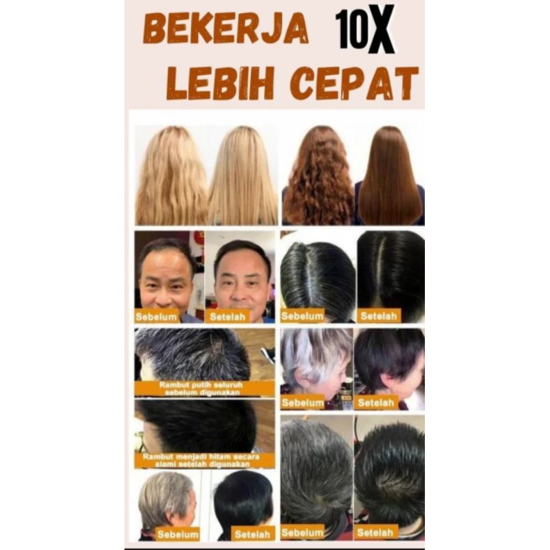 SCHEINEN RAMBUT PAKET LENGKAP - Perawatan Rambut No 1 Di Germany Tuntaskan Segera Masalah Rambut Anda Mengatasi Rambut Beruban Menyuburkan Rambut Anti Ketombe